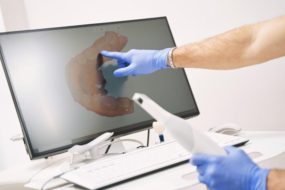 Say Goodbye to Messy Impressions: The Advantages of Digital Scans