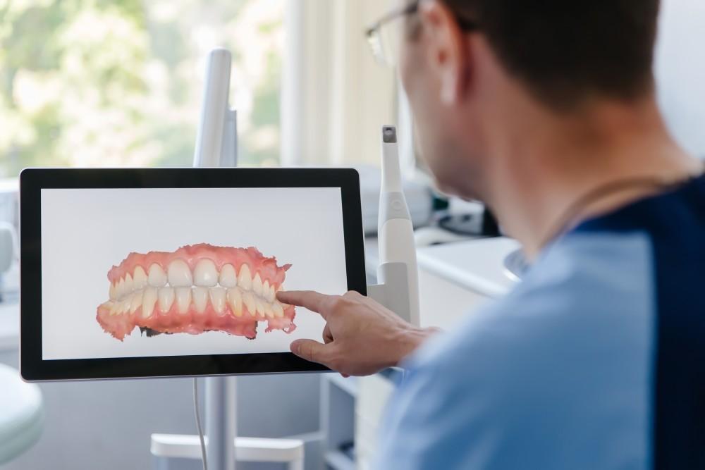 The Benefits of Digital Impression Scans Over Traditional Dental Putty