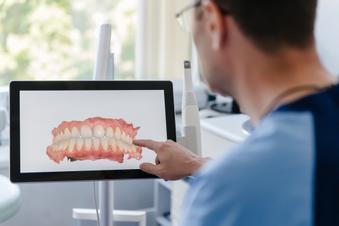 The Benefits of Digital Impression Scans Over Traditional Dental Putty